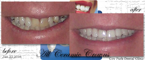 Smile Makeovers:Phuket Dental Clinic